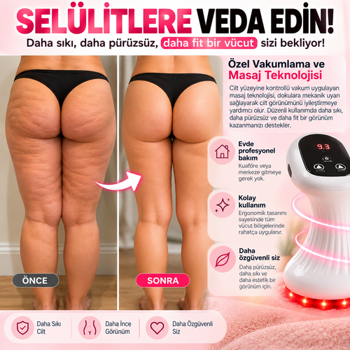 Selülit Masaj Aleti – Vakumlu Vücut Şekillendirici ve Sıkılaştırıcı Bakım Cihazı